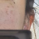 팜스메디 | [제품 후기] 내돈내산 2주 사용 솔직후기 기미크림/미백크림 메디테라피 멜라쥬란 화이트 토닝 크림...