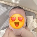 화산삼성의원 | 오쏘코리아 헬멧 6개월에 시작하여 100일만에 사두 졸업한 후기 내돈내산 찐 장단점 (20만원 할인혜택)_2탄