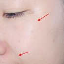 티이씨 (Total Eye Care) | 눈가 탄력과 주름개선을 한 번에, 노니피아 아이패치