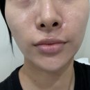 숨앤쉼에스테틱 | 모공관리 추천 숨앤쉼에스테틱에서 꼼꼼하게 받은 모공 케어 후기