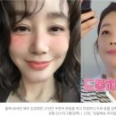 동안비결Beauty 이미지