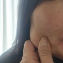 마이클래식피부과의원 | 창원피부과의원추천-마산엔 없는 올타이트 받으러 내돈내산 후기!(통증.시술시간.내돈내산)