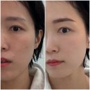 오늘도예쁘게 | 월곡역 눈썹 오늘뷰티 에서 예쁘게 한 후기