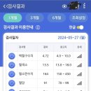 골수 이식 3년차 진료 이미지