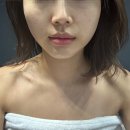 대구 수성구 피부관리 에이원뷰티그룹 벨로체고주파리프팅 후기