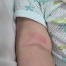 대야행복한어린이집 | ~146일 아기의 어린이집 12일차 적응끝 / 지독한 피부염 / 보라매병원 아기 사경진료 본 후기