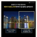 - | 렌즈삽입술 후기 확인하면서