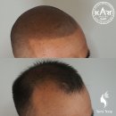 새로이숲부평 이미지