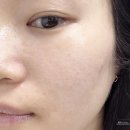 경산 피부관리 잘하는 곳 유뷰티, 경산 아쿠아필 후기