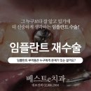 올바른약속치과 네이버블로그