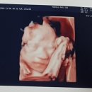 내토메디칼약국 이미지