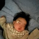 재준이집 | [평택강남재준성형외과] 8개월 아기 얼굴 찢어짐, 수면마취 봉합수술 후기(1)