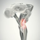 베스트정형외과의원 | 백석동 정형외과 무릎 퇴행성 관절염 단계별 비수술 치료법 완벽 가이드