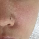 랩올 | 동탄모공 [셀리올리스킨랩 동탄] 트라이엄 모공관리 후기