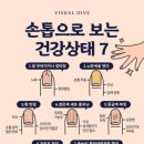 손톱 티스토리