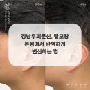 탈모왕 본점 이미지