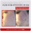 오닉스스킨테라피 이미지