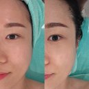 고운손길 | 창원 피부관리 고운빛깔에스테틱 창원상남점에서 온.다웨이브 받은은 후기