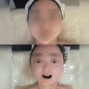 세븐일레븐 김제검산택지점 | 김제 에스테틱 더가꿈 이중턱관리 받고 온 솔직 후기