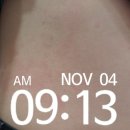 오렌지반점 | 내돈내산 인케어바이오 후기 붉은반점 부어오름 돔관리 멀티컵관리