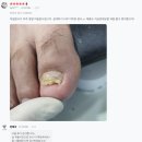 헬룩스 | 헬룩스제품을 이용한 일반인 후기모음