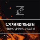 거제통영 화상치료 피부과 포기했던 오래된 화상자국 다시 바라봐야 할 때