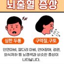 “뇌출혈 초기, 알고만 있다면 못 놓치는 11가지 전조!” 이미지