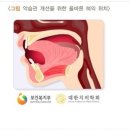 얼굴형이 바꿘다는 혀의 올바른 위치 jpg 이미지