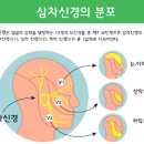 삼차신경통 증상 및 진단 (3차신경통 오른쪽 왼쪽 얼굴통증, 씹을때통증 치통) 이미지