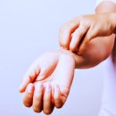 알레르기 이미지