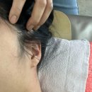 동안을 부르는 얼굴&두피관리 이미지