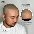 프로스칼프부산 이미지