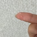 레티놀 팔자주름패치 내돈내산 후기 사용법 효과 부작용