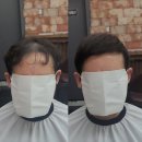 수원-1578 | 수원에서 정수리 엠자 탈모펌 전문 미용실 찾아서 오신 고객님 시술 리뷰와 후기