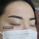 라인투라인