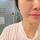 김포피부관리 추천, 풍무동피부관리 이끌림스킨앤바디 크라이오 케어 후기