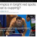 왜 사람들은 대체의학을 찾게 되었을까? 이미지