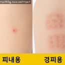 모든차병원 | 분당 차병원, 신생아 BCG 필수 접종 후기 + 피내용 경피용 차이
