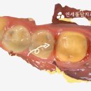 더프라임치과기공소 이미지