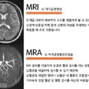 뇌 MRI MRA에 대한 모든 것 : 비용 가격 이미지