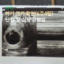 새코미랑달코미 | [임신_6주4일] 아기 크기 보고 난황 및 심장 깜빡임 확인 / 입덧약 처방 / 입덧에 좋은 음식