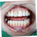 트리덴탈 이미지