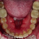 서수원치과의원 | 수원정자동치과 블로그로 찾아보지 마세요