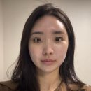 뮬피부과의원 | 부산 해운대 센텀피부과, 엠페이스 리프팅 시술 후기(다운타임, 추천여부, 효과)