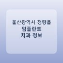 울산광역시 청량읍 임플란트 치과 비교, 가격 후기 링크 모음