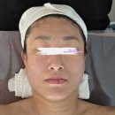 광명에스테틱 1:1 관리 받고 턱선 달라진 후기✨ 딱 1시간의 변화 클레오 에스테틱