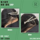 림 스칼프 이미지