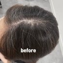하비컨설팅 | 노원 임산부염색 찾는다면? 두피 자극 걱정줄인 하비카 염색후기