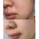 제네틱 | 환절기피부 뒤집힘 해결책 찾는다면 제네틱 씨토비 (내돈내산 후기)