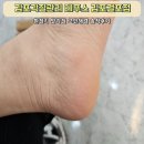 레푸스김포걸포점 | 김포각질관리 레푸스 김포걸포점 환절기 발각질 고민해결 솔직후기